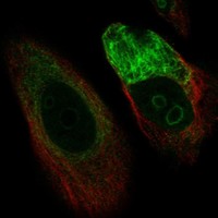 Anti-C1orf159 Antibody