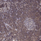 Anti-ACAP1 Antibody