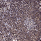 Anti-ACAP1 Antibody