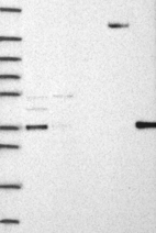 Lane 1: Marker [kDa] 250, 130, 95, 72, 55, 36, 28, 17, 10 | Lane 2: RT4 | Lane 3: U-251 MG | Lane 4: Human Plasma | Lane 5: Liver | Lane 6: Tonsil