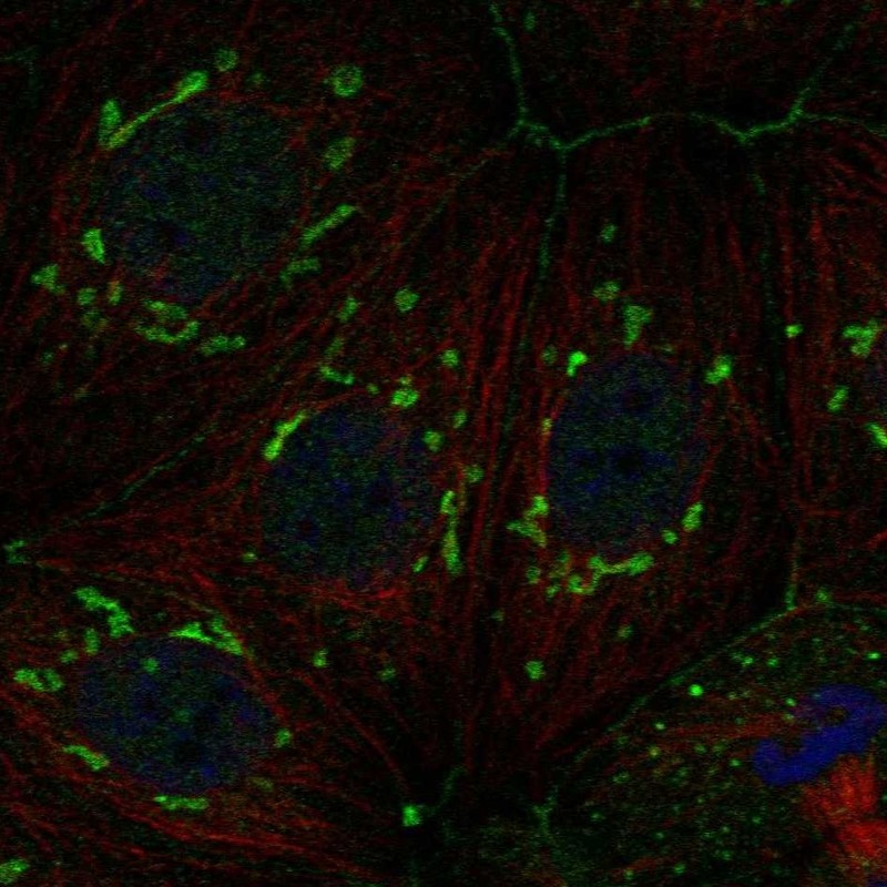 Anti-FAM222A Antibody