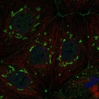 Anti-FAM222A Antibody