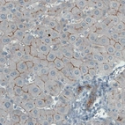 Immunohistochemical staining of human liver shows membranous immunoreactivity in hepatocytes.