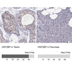 Anti-HSF2BP Antibody