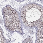 Immunohistochemical staining of human testis shows high expression.