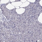 Immunohistochemical staining of human pancreas shows low expression as expected.