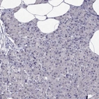 Immunohistochemical staining of human pancreas shows low expression as expected.