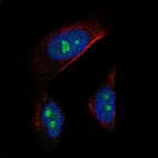 Anti-AATF Antibody