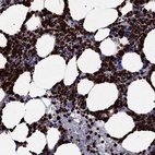 Immunohistochemical staining of human bone marrow shows high expression.