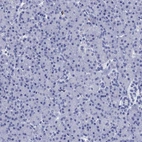 Immunohistochemical staining of human pancreas shows low expression as expected.