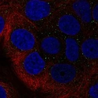 Anti-RAB40B Antibody