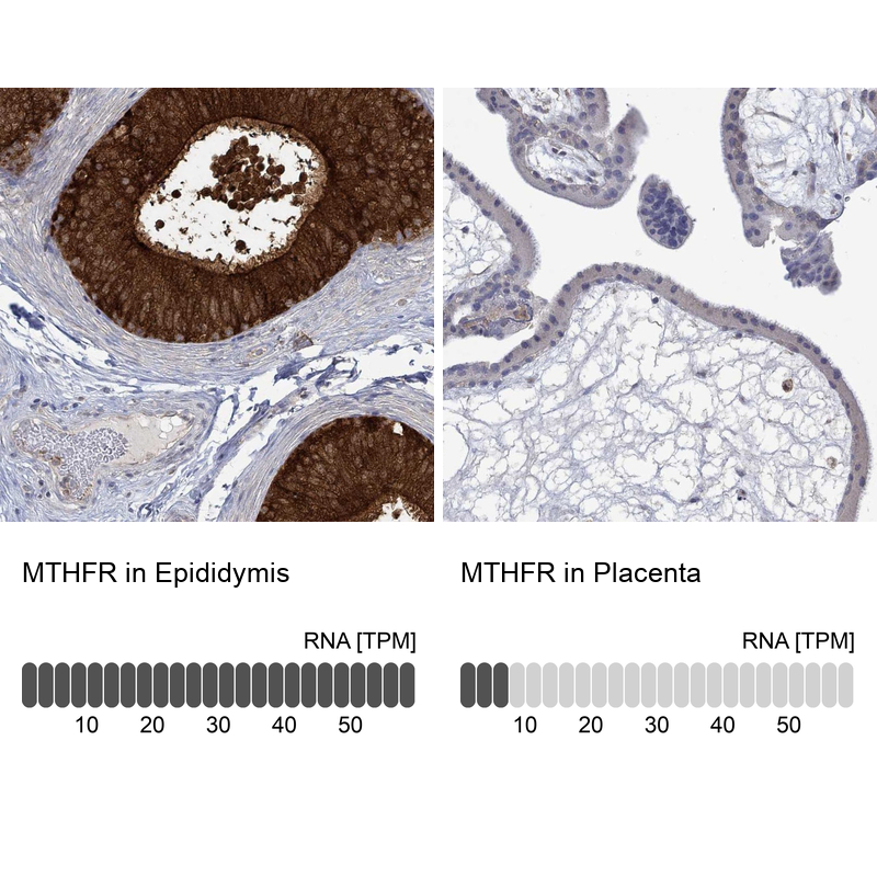 Anti-MTHFR Antibody