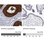 Anti-MTHFR Antibody