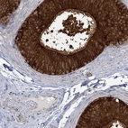 Immunohistochemical staining of human epididymis shows high expression.