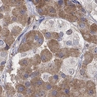 Immunohistochemical staining of human pituitary gland shows strong positivity in most anterior cells.