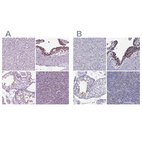 Immunohistochemical staining of human liver, placenta, testis and tonsil using Anti-ARID3A antibody HPA076330 (A) shows similar protein distribution across tissues to independent antibody HPA004793 (B).