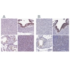 Immunohistochemical staining of human liver, placenta, testis and tonsil using Anti-ARID3A antibody HPA076330 (A) shows similar protein distribution across tissues to independent antibody HPA004793 (B).