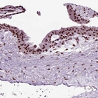 Immunohistochemical staining of human placenta shows strong nuclear positivity in trophoblastic cells.