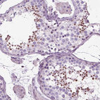 Immunohistochemical staining of human testis shows moderate nuclear positivity in cells in seminiferous ducts.