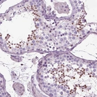 Immunohistochemical staining of human testis shows moderate nuclear positivity in cells in seminiferous ducts.