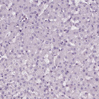 Immunohistochemical staining of human liver shows no positivity in hepatocytes as expected.