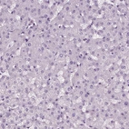 Immunohistochemical staining of human liver shows no positivity in hepatocytes as expected.