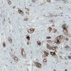 Anti-OCLN Antibody