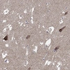 Anti-C9orf85 Antibody