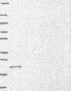 Lane 1: Marker [kDa] 250, 130, 95, 72, 55, 36, 28, 17, 10 | Lane 2: RT4 | Lane 3: U-251 MG | Lane 4: Human Plasma | Lane 5: Liver | Lane 6: Tonsil