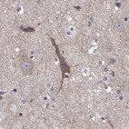 Anti-CLVS1 Antibody