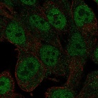 Anti-RNF113A Antibody