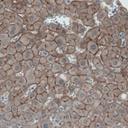 Immunohistochemical staining of human liver shows membranous immunoreactivity in hepatocytes.