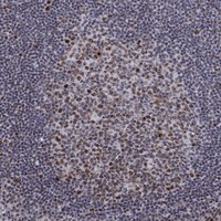 Anti-SPOUT1 Antibody