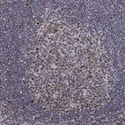 Anti-SPOUT1 Antibody