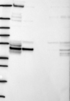 Lane 1: Marker [kDa] 250, 130, 95, 72, 55, 36, 28, 17, 10 | Lane 2: RT4 | Lane 3: U-251 MG | Lane 4: Human Plasma | Lane 5: Liver | Lane 6: Tonsil