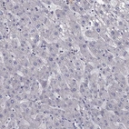 Immunohistochemical staining of human liver shows low expression as expected.