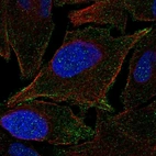 Anti-JAM2 Antibody
