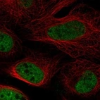 Immunofluorescent staining of human cell line U-2 OS shows localization to nucleoplasm.