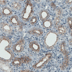 Anti-OCLN Antibody