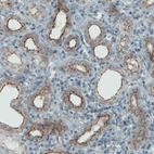 Immunohistochemical staining of human kidney shows membranous positivity in renal tubules.