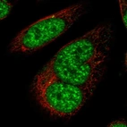Immunofluorescent staining of human cell line SiHa shows localization to nucleoplasm & nuclear speckles.