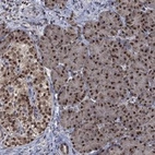 Anti-FBL Antibody