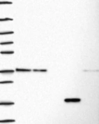 Lane 1: Marker [kDa] 250, 130, 95, 72, 55, 36, 28, 17, 10 | Lane 2: RT4 | Lane 3: U-251 MG | Lane 4: Human Plasma | Lane 5: Liver | Lane 6: Tonsil