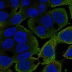 Immunofluorescent staining of human cell line OE19 shows localization to plasma membrane.