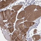 Immunohistochemical staining of human skeletal muscle shows strong cytoplasmic positivity in myocytes.
