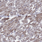 Immunohistochemical staining of human heart muscle shows weak cytoplasmic positivity in cardiomyocytes.