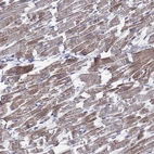Immunohistochemical staining of human heart muscle shows weak cytoplasmic positivity in cardiomyocytes.