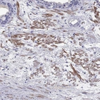 Immunohistochemical staining of human prostate shows moderate cytoplasmic positivity in smooth muscle cells.