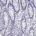 Immunohistochemical staining of human rectum shows no cytoplasmic positivity in glandular cells as expected.