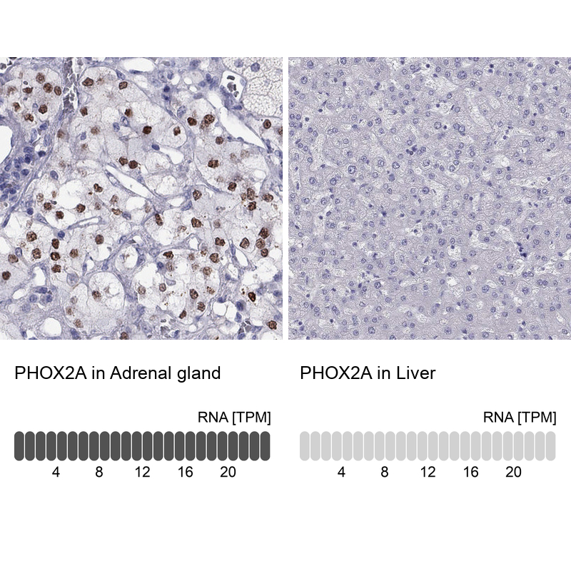 Anti-PHOX2A Antibody